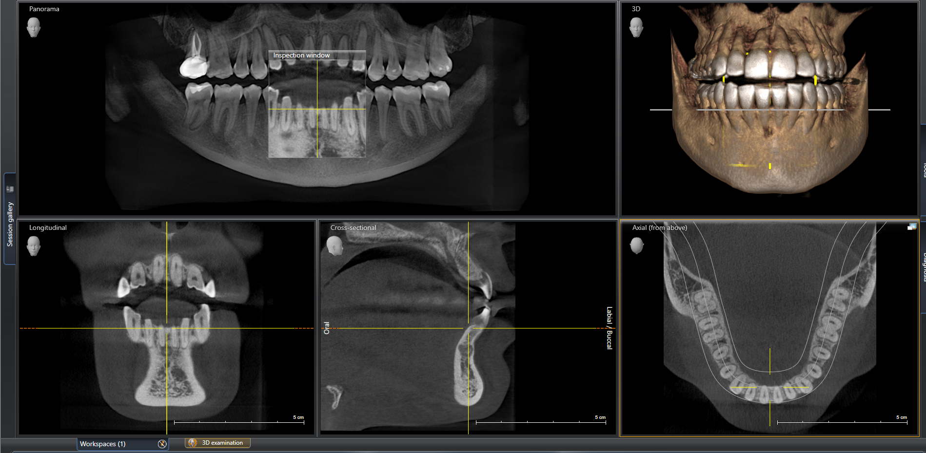 3d Cone Beam Ct Dental X Rays Heritage Dental Group